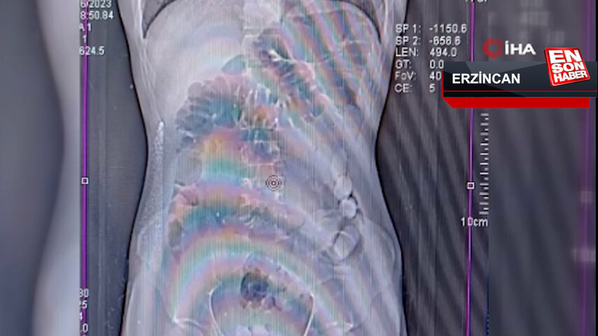 Erzincan’da midede uyuşturucu sevkiyatı
