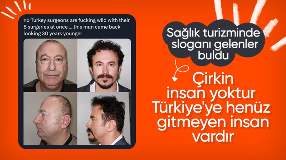 Türkiye’de estetik yaptırıp 30 yaş gençleşen adam