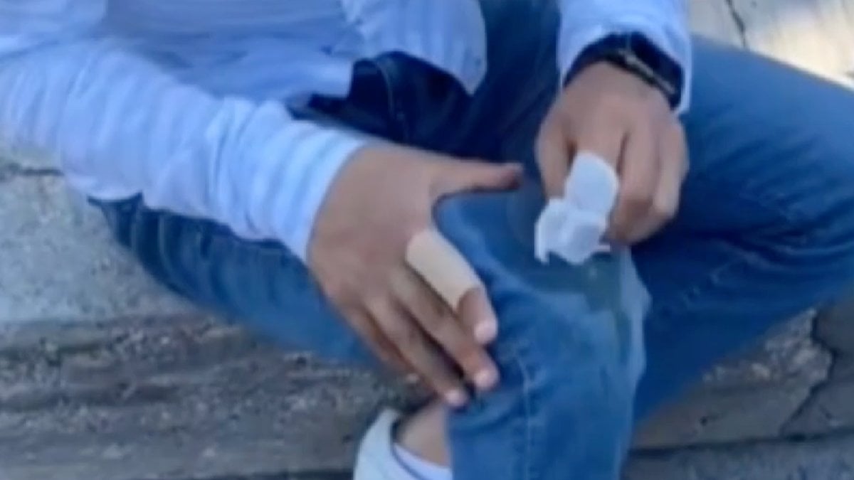 Gaziosmanpaşa’da başıboş pitbull 2 kişiye saldırdı